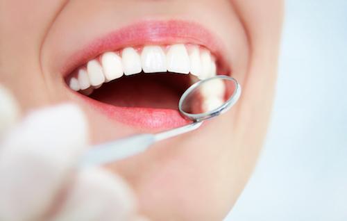 woman with open mouth with dental exam tool 